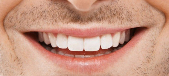 dentes-brancos